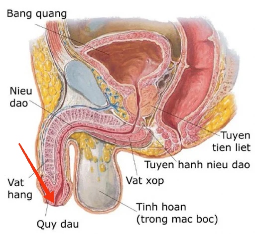 Hẹp lỗ sáo